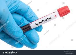 Ascitic Fluid Test - Protein Total