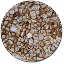 PD-L1 (22C3) Dako CPS IHC Test