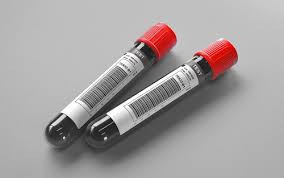 (Topamax) Topiramate  Serum Test