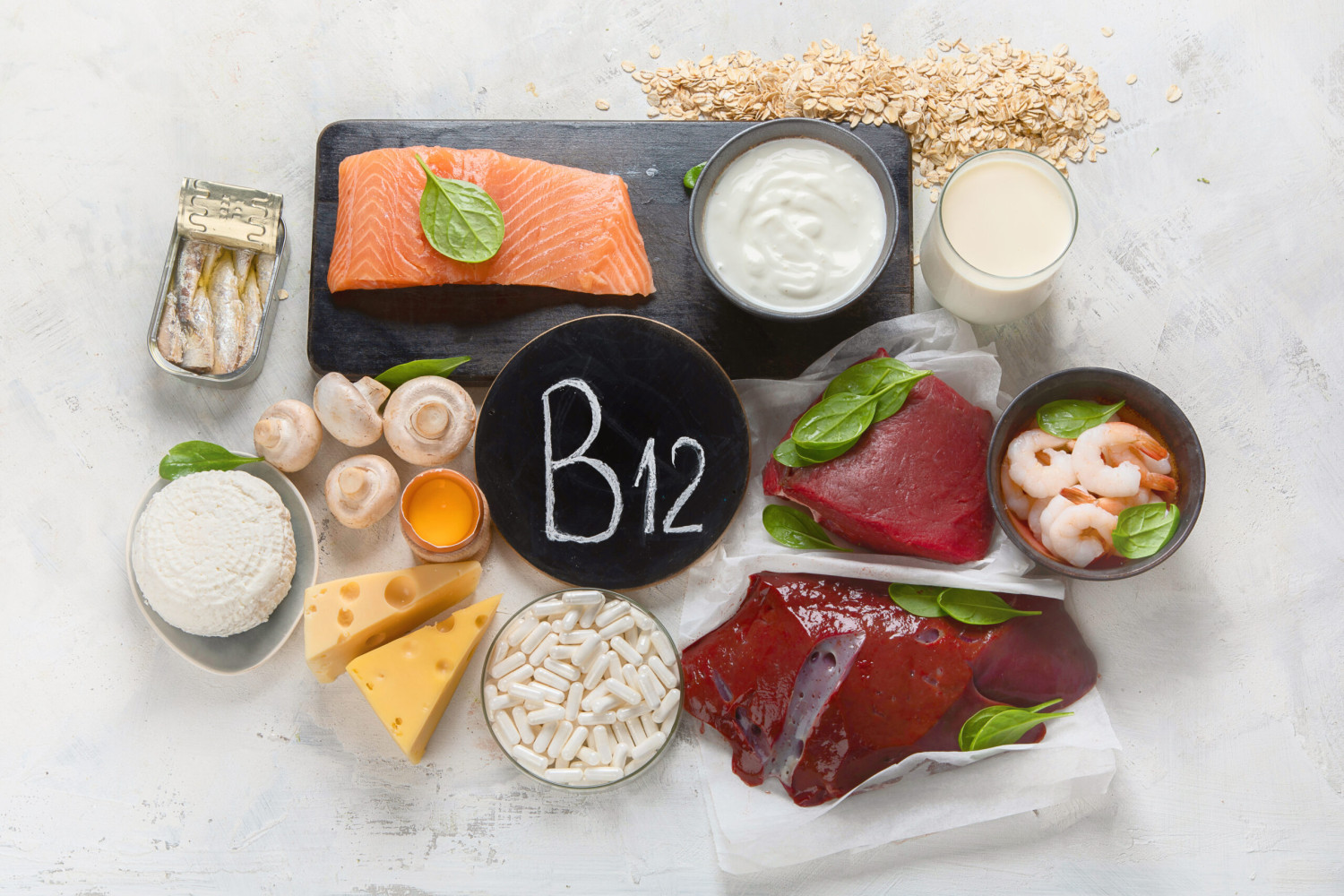 Vitamin B12 IM