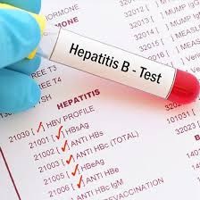 Hepatitis Marker Screen