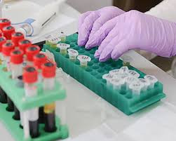 TPMT Enzyme Activity Test