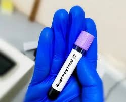 Respiratory comprehensive 25 Pathogens Test