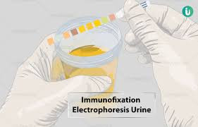 Urine Immunofixation Test