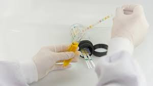 (Random Urine) Protein/Creatinine Ratio Test