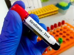 (Sirolimus) Rapamycin  Serum Test