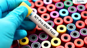 (proBNP) Test proBrain Natriuretic Peptide