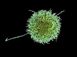 Natural Killer (NK) Inhibition Profile Test