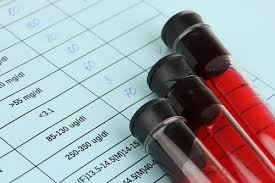 Lipo Profile Advanced NMR Blood Test