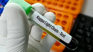 (Serum) Test High-Precision Kappa Light Chain