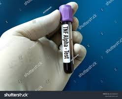 High-Purity (TNF)  Tumor Necrosis Factor Test