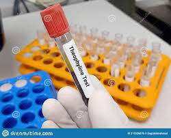 Serum Test, Theophylline