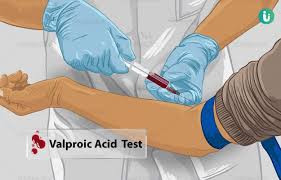 (Depakin Level)  Valproic Acid Serum Test