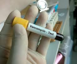 Vancomycin Serum Test