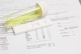(Urine) Test Phenobarbital