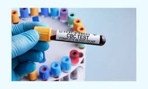 Complete Blood Count (CBC) test