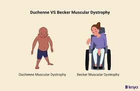 MUSCULAR DYSTROPHY DUCHENNE/BECKER (DMD/BMD) GENE MUTATION