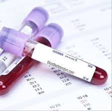 (Prograf) Tacrolimus  Whole Blood Test