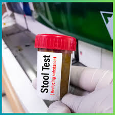 Reducing Substances – Accurate, Rapid Detection of Carbohydrate Malabsorption for Digestive Health  (Stool) Test Kit