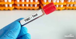 Total Iron Binding Capacity (TIBC) Test