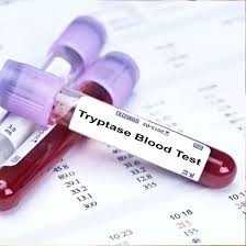 Enzyme Tryptase Test