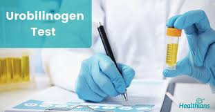 Urobilinogen (Random Urine) Test