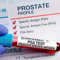 (PSA) Prostatic Specific Antigen  Ratio Test