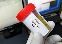 Calprotectin Test