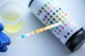 Rapid Opiates Detection Urine Test